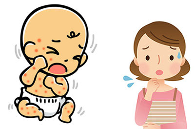 乳児の湿疹いつまで 乳児湿疹っていつまで出るの?原因を知って上手に対策しよう!